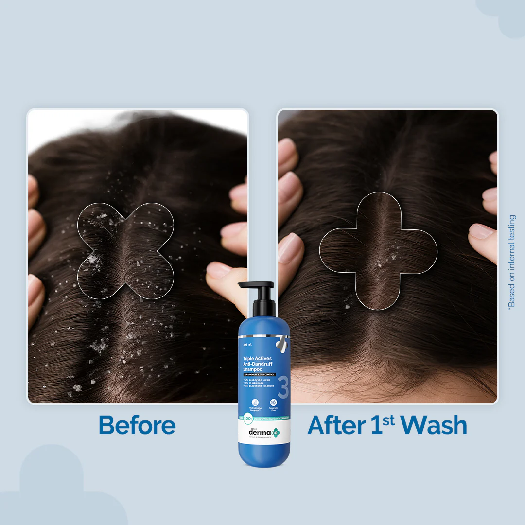 Triple Actives Anti-Dandruff Shampoo - 400ml - Image 5